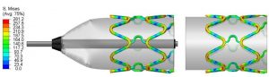 Stent with Abaqus simulation (FEA)